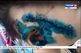 В Хилке огромный алабай едва не загрыз 6-летнюю девочку  