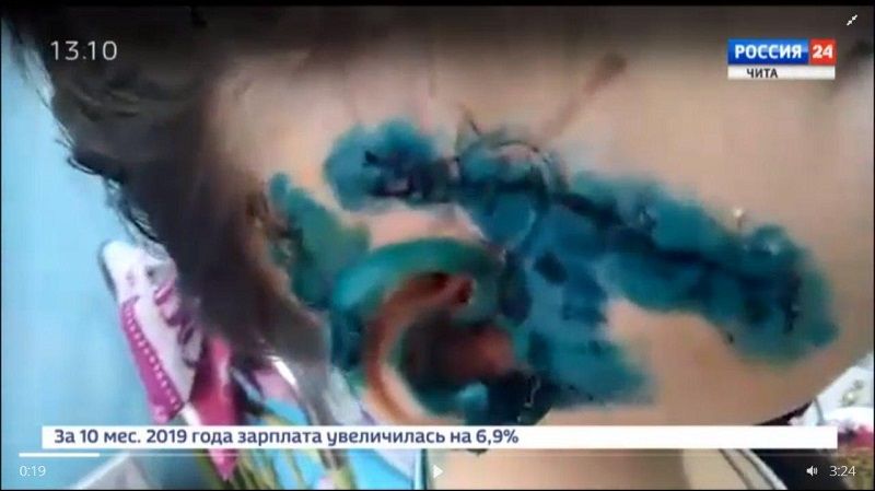 В Хилке огромный алабай едва не загрыз 6-летнюю девочку  