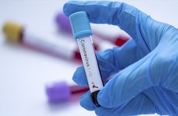 У восьми жителей Борзинского района выявлен коронавирус