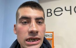 Негодяй, избивший участника спецоперации на Украине, будет наказан