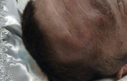 Участник СВО найден мертвым в воинской части в Борзе