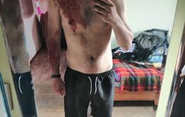 На жителя Бурятии напала рысь