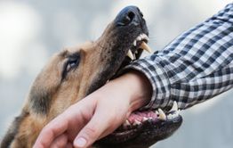 В Чите собака укусила 8-летнего ребенка