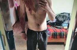 На жителя Бурятии напала рысь