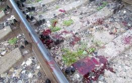 Молодому парню в Карымской почти отрезало ноги поездом
