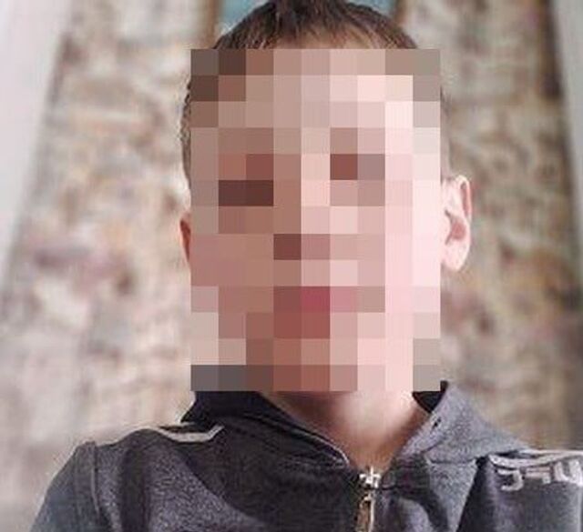 Мальчик пострадал от взрыва кофемолки в Забайкалье