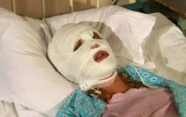 Пьяная женщина обезобразила ножом лицо своей подруги