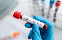 Забайкальцы смогут бесплатно сдать тест на ВИЧ 25 ноября в Чите