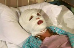 Пьяная женщина обезобразила ножом лицо своей подруги