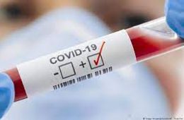 18 забайкальцев заразились коронавирусом за сутки