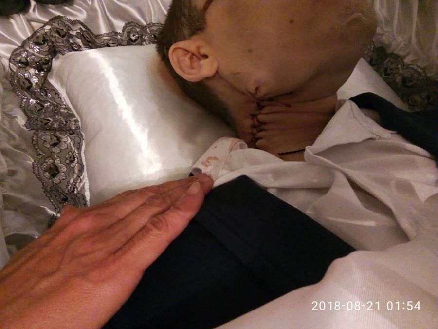 Заключенного Читинского СИЗО-1 обнаружили с перерезанным горлом