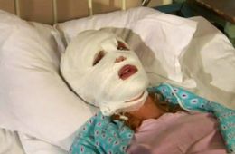 Пьяная женщина обезобразила ножом лицо своей подруги